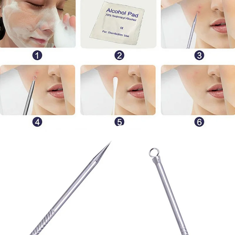 

5pcs blackhead comedone acne pimple belmish extractor,vacuum blackhead remover,acne/blackhead extractor tool,Spoon for face new