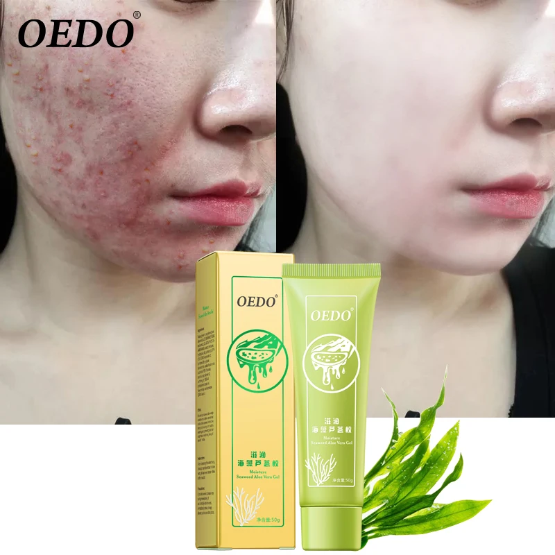 spesifikasi Rumput Laut Gel Lidah Buaya Hydrating Whitening Krim Pagi Jerawat Anti Penuaan Kerut Kolagen Pemutih Wajah Cream Mencerahkan Kulit