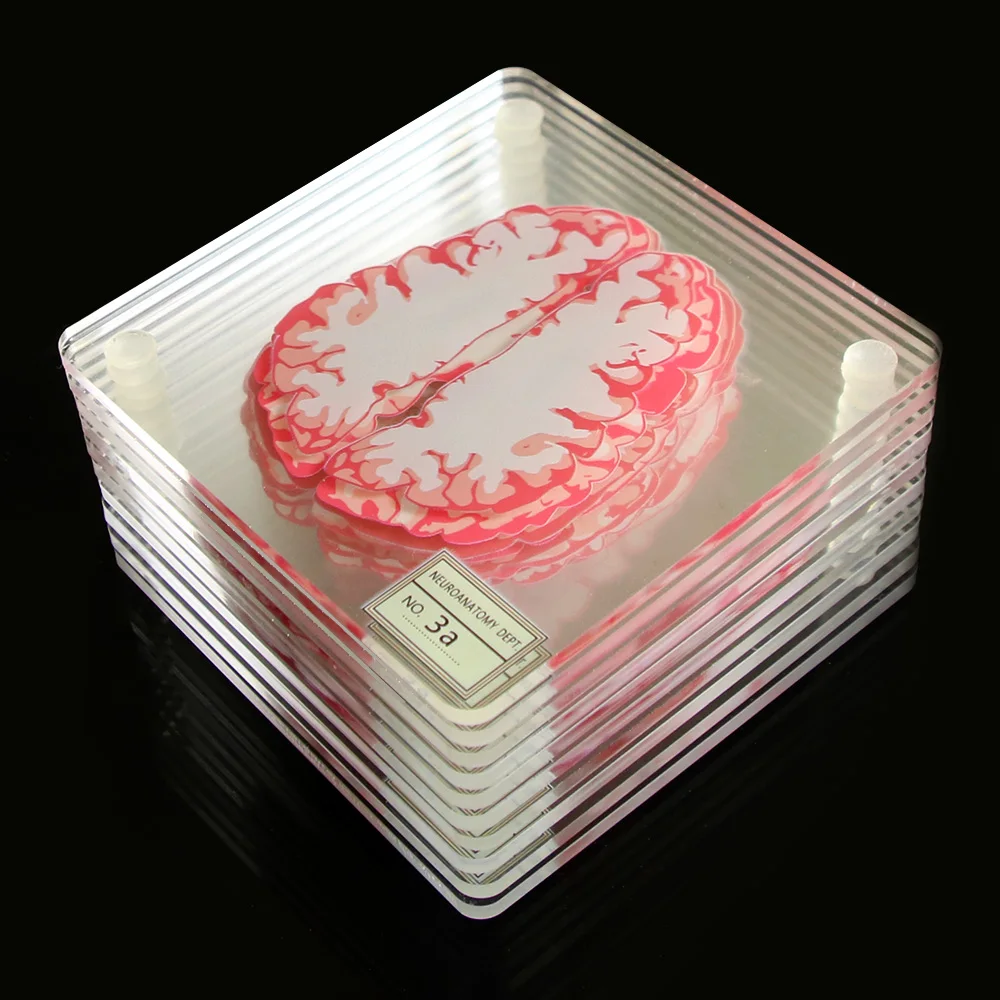 10 шт./компл. 3D Органы мозга образца, наборы подставок из столик для напитков Coaster мозга ломтики квадратного акрилового Стекло секс учеными подарок
