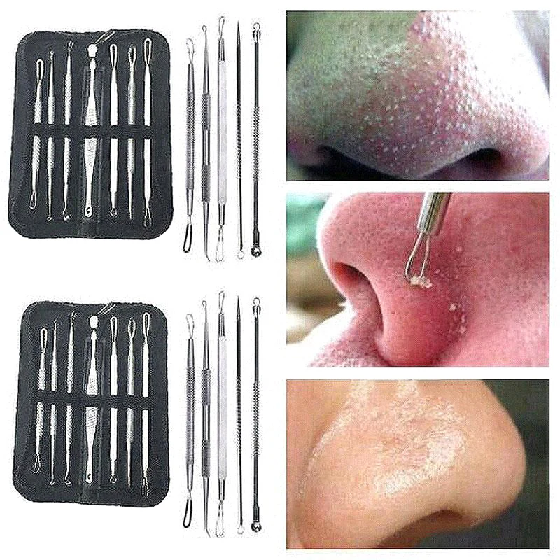 Useful 7pcs/set Hot Stainless Steel Blackhead Whitehead Pimple Acne