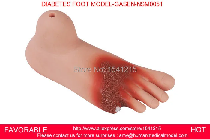 

MEDICAL NURSING,DIABETIC FOOT NURSING SIMULATOR, DIABETIC FOOT CARE MODEL,NURSING MODEL DIABETES FOOT MODEL-GASEN-NSM0051