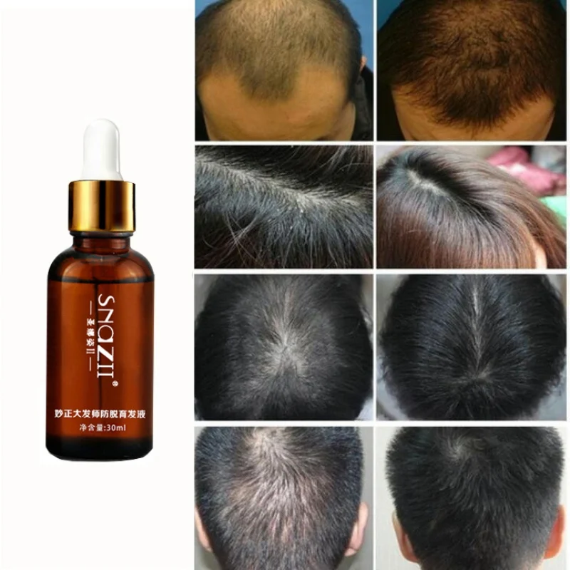 30ml Liquid Hair Care Growth Essence Hair Thickening Fibers Hair