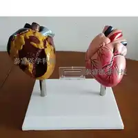 Human heart model smoking harms model education pathological heart free shopping
