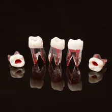 100 шт. зубной зуб корневой модель канала для RCT практики целлюлозы Стоматологическая модель стоматологические материалы Стоматологические Инструменты
