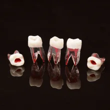 Modèle de Canal radiculaire dentaire, 100 pièces, pour RCT, pratique de la pulpe, modèle de laboratoire de dentisterie, matériaux dentaires, outils de dentiste
