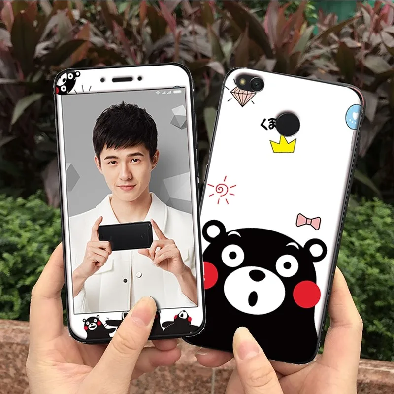  Xiaomi redmi 4X case cover glass screen protector  (30)