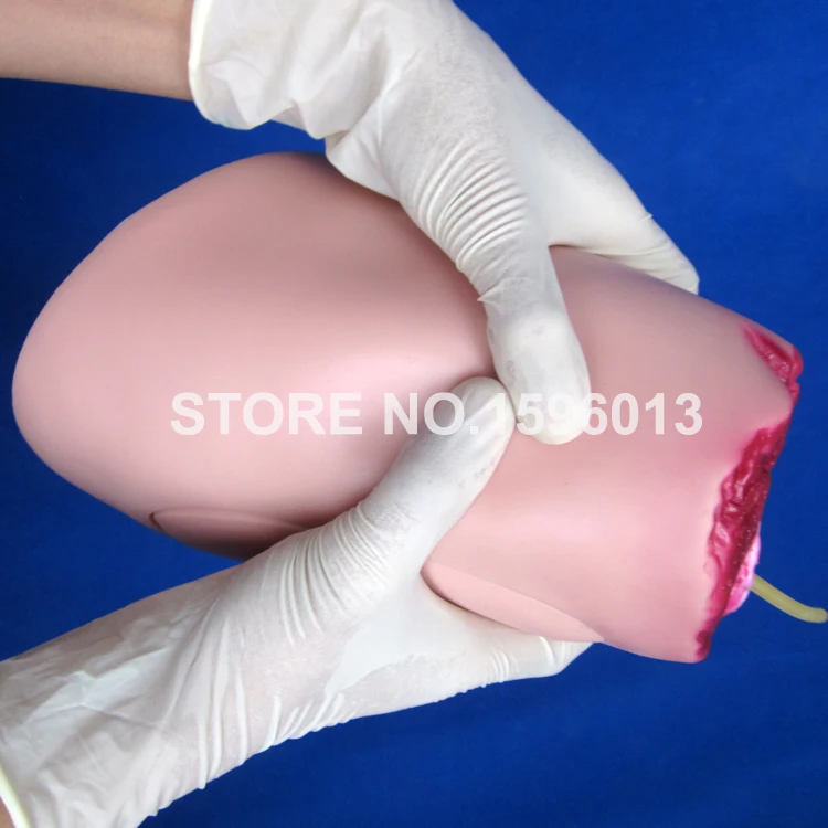 J108-2 amputation (9)