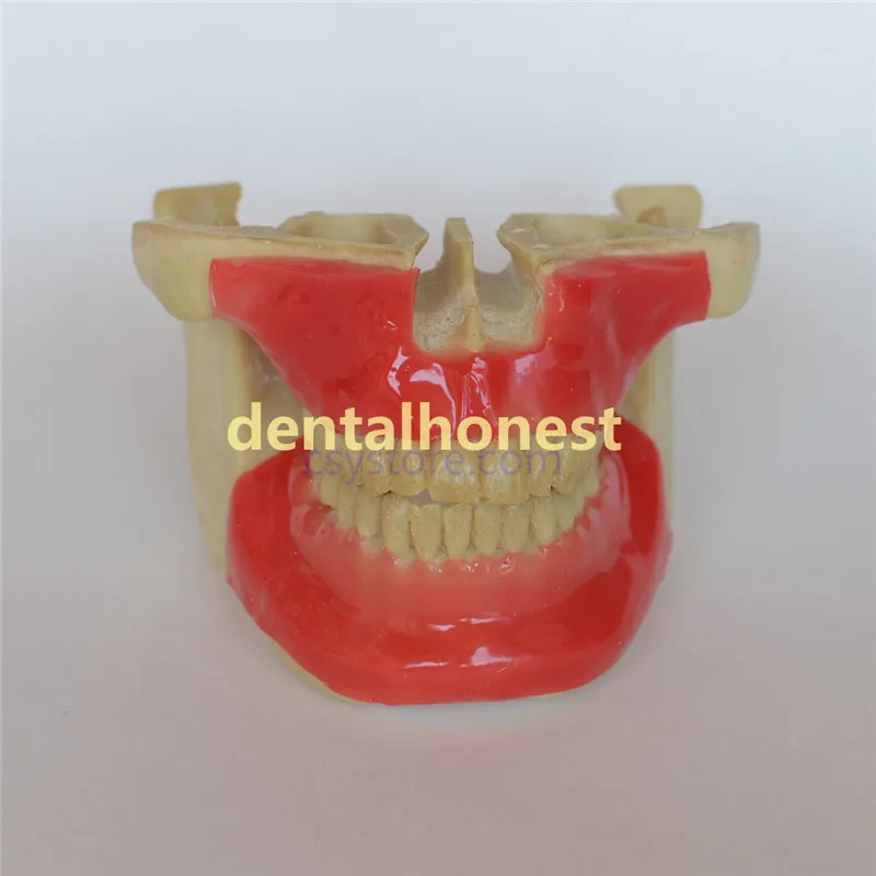 

2019 Dental Model #203101 Orthodontic Anchor Implant Screw Practice Model with Tissue