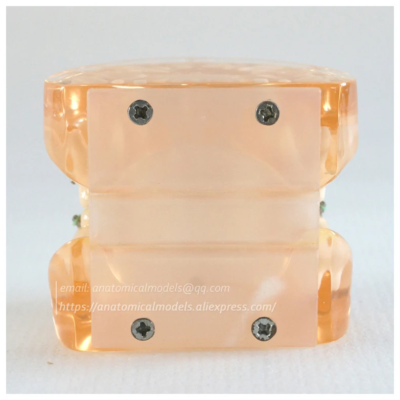 13024 DH202-2 Ortho Metal&Ceramic 2 