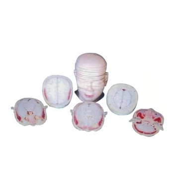 

Anatomical model of brain fault Brain structure demonstration model 19*17.5*24.5cm free shipping
