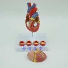 И роскошная модель сердца, модель сердечной анатомии с 4 стадиями сердечно-сосудистой системы, Школьное медицинское обучение