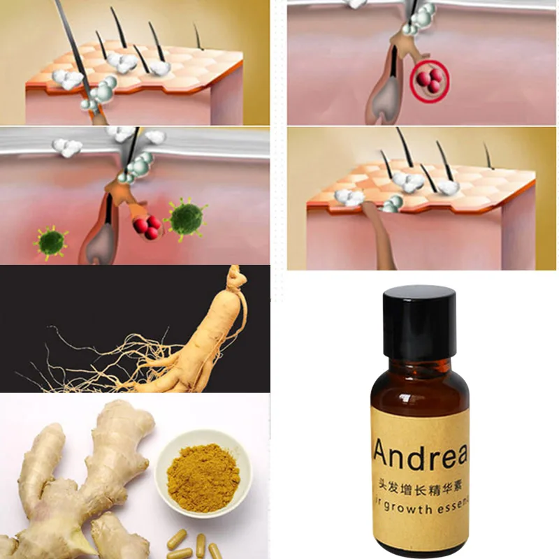 

Hot 20ml Hair Growth Essence Liquid Help Hair Growing Anti Hairs Loss Nourishing Essences for Hair Care SJ66