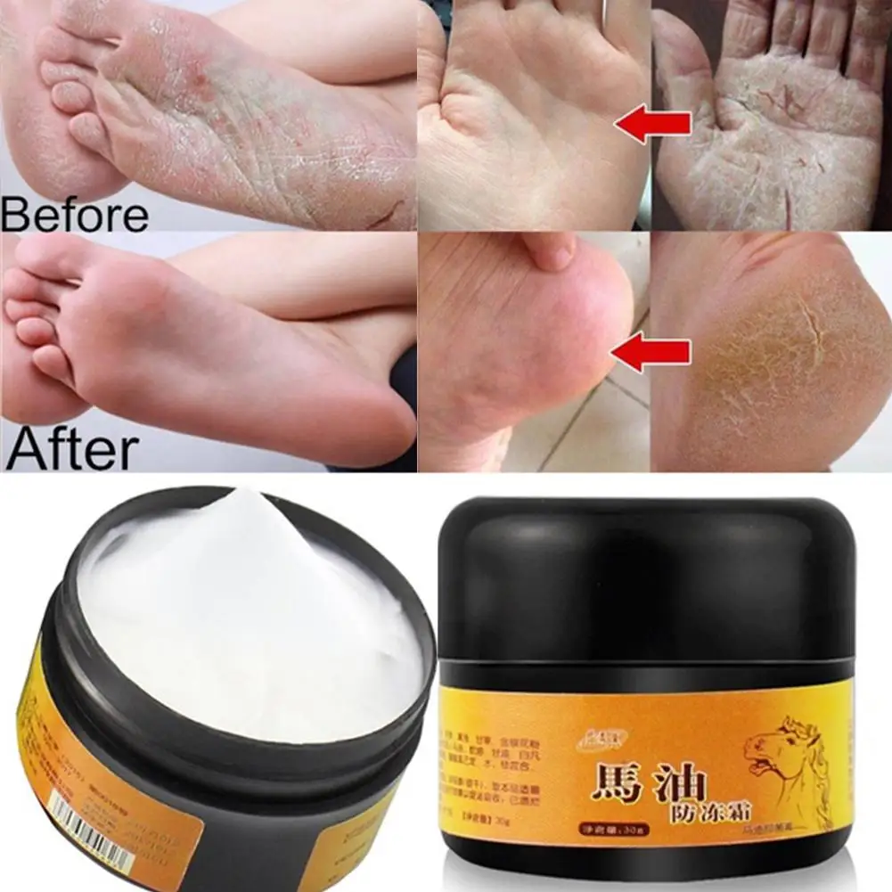 

VIBRANT GLAMOUR Horse Oil Foot Cream Feet Care Itch Anti-chapping Peeling Ointment Anti-Chapping Skin Repairing Moisturizer
