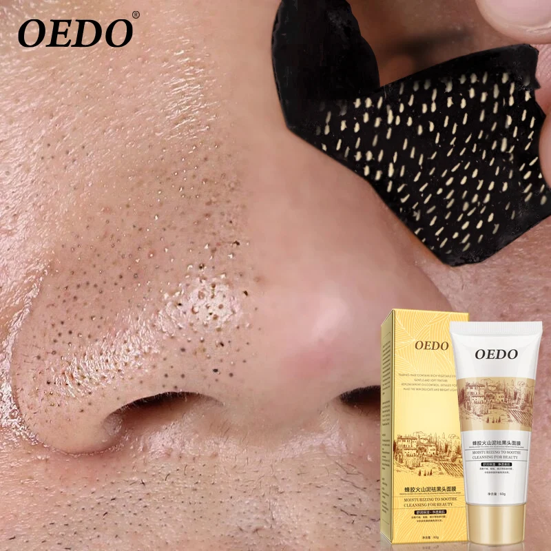 

Volcanic Soil Facial Mask Acne Remove Blackhead Mite Propolis Face Care Treatment Repair Whitening Cream Skin Care Moisturizing