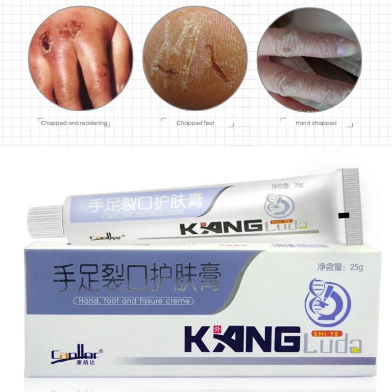 

Ointment Hand Foot Crack Cream Heel Chapped Peeling Repair Moisturizing Frostbite Anti Dry Crack Skin Creams Hot Wholesale