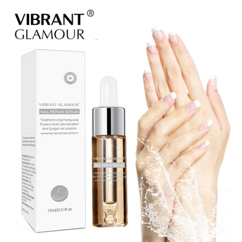 

Herbal Antibacterial Fungus on Feet and Hand Disinfection Nail Fungal Treatment Oil Feet Care Nail Gel for Onychomycosis TSLM1