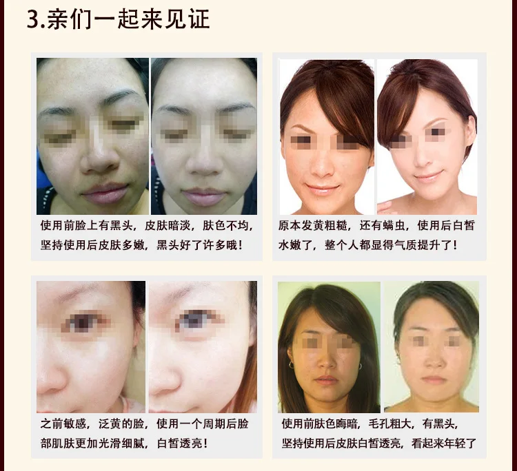 CAICUI медицинские маски для кожи лица отбеливающий увлажняющий крем традиционное китайское средство от черных точек акне Лечение Уход за