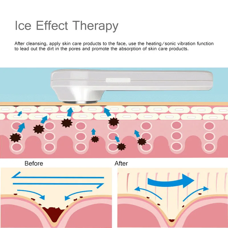 Ультразвуковая Вибрация горячий и холодный молоток для затягивания лица и подъема термальная ледяная терапия усадка поры против морщин Массажер красоты