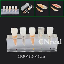 1 pc Dental Teeth Model Decomposable for Pulp Treatment Pathology Series and Doctor-Patient Communication 1 pc Dental Teeth Model Decomposable for Pulp Treatment Pathology Series and Doctor-Patient Communication