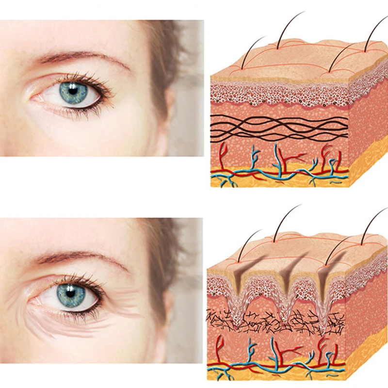 сыворотка для глаз boto-line medical collagene 3d. Medical collagene 3d коллагеновая гель-маска aqua balance home line. либридерм коллаген крем для кожи контура глаз 20 мл. либридерм коллаген крем омолаживающий. эластин в коже.