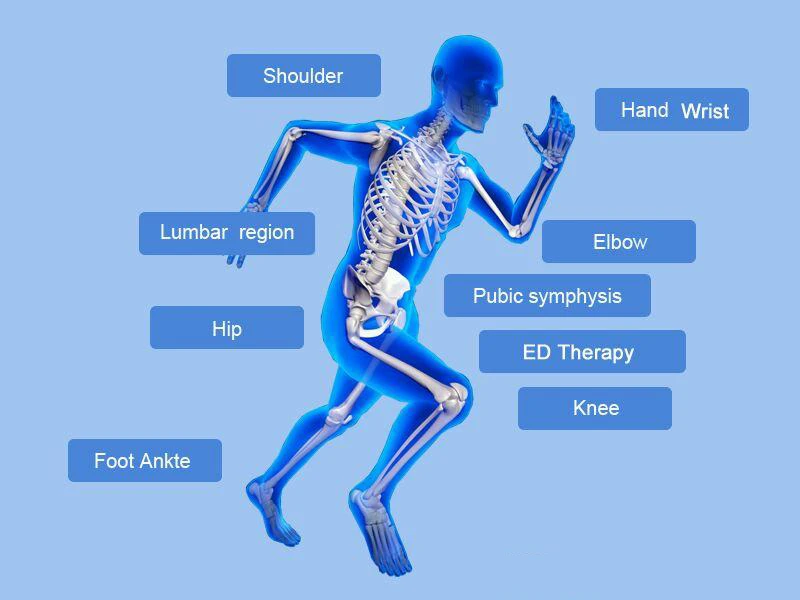 German Imported Compressor Shock wave machine Shockwave Therapy Machine Extracorporeal Shock Wave Therapy Equipment CE 5