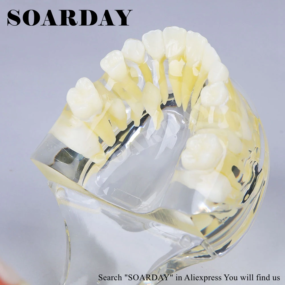 SOARDAY детский первичный ретейнер для зубов Денто-модель Учебная модель стоматологические материалы первичные зубы преждевременная потеря