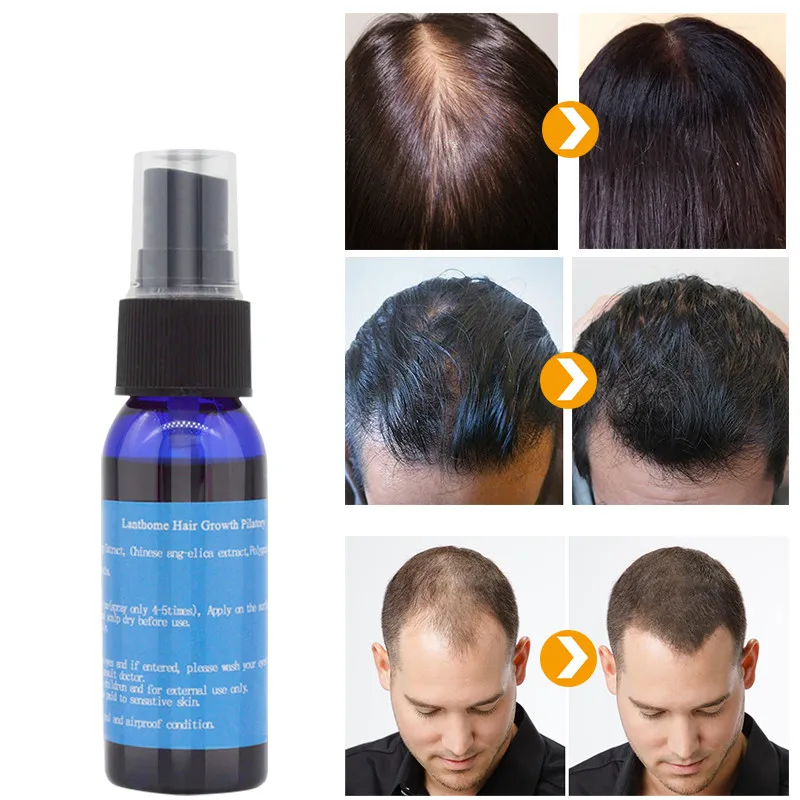 New 30ml Hair Fast Growth Oil Hair Regrowth Essence Treatment Anti Hair Loss Liquid Hair Care Growth Oil Chinese Recipe TSLM2