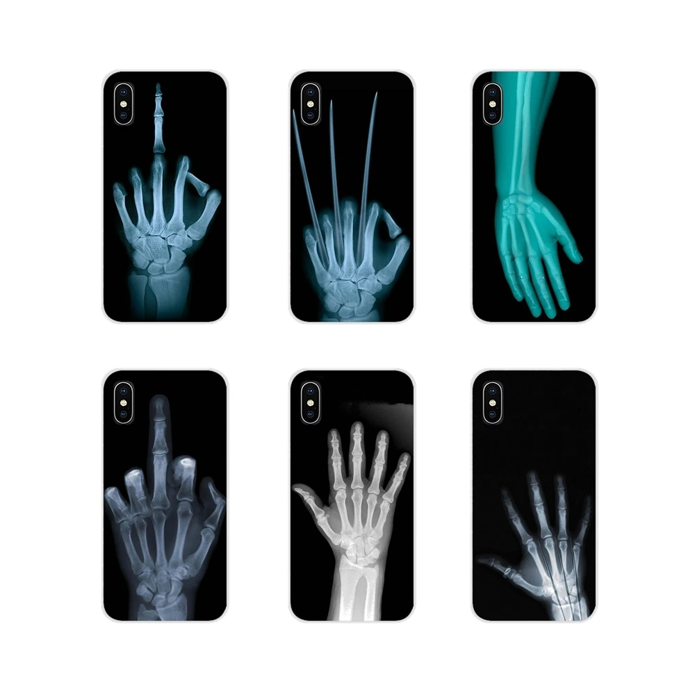 

Soft Transparent Covers Wolverine X-ray Hand Bones Poster For Samsung Galaxy S4 S5 MINI S6 S7 edge S8 S9 S10 Plus Note 3 4 5 8 9