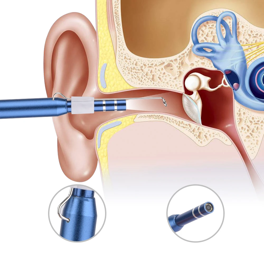 3в1, эндоскоп для чистки ушей, визуальная трубка для ушей, камера, USB, инспекционный светодиодный бороскоп для телефона Android, ПК, инструмент для очистки ушей