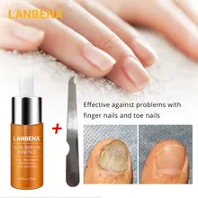 LANBENA ремонт ногтей эссенция сыворотка Лечение ногтей от грибка удаление онихомикоза ноготь питательный осветление рук и ухода за ногами