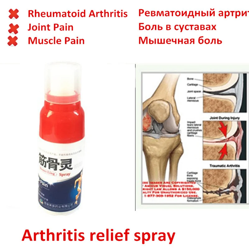 Горячая обезболивающий спрей ревматизм артрит пластырь растяжение мышц колена талии боли в спине плечо спрей Тигр ортопедический пластырь