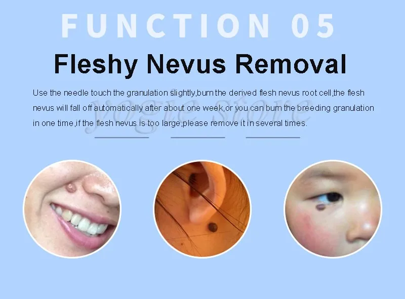 mole-removal-machine-9