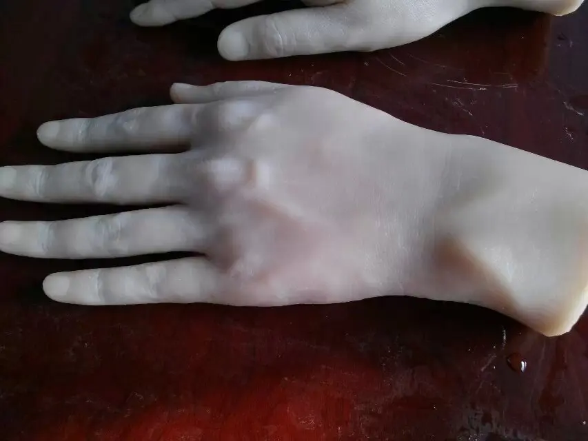 thumb