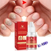 Лечение грибковых ногтей эссенция отбеливание ногтей и ног питательное масло для кутикулы ног удаление грибка Уход за ногами Гель для ногтей 10 мл