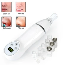 Портативный очиститель пор для лица, лба, носа, для удаления угрей и акне, инструмент для чистки кожи, для мужчин и женщин