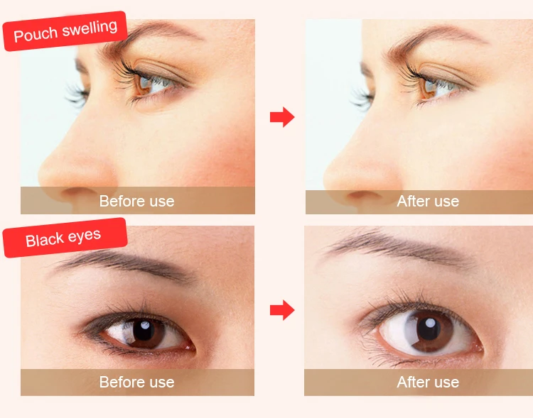 lifting eye cream for eye bags (5)