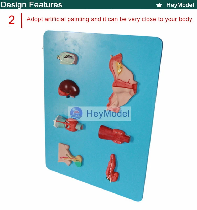 2. _