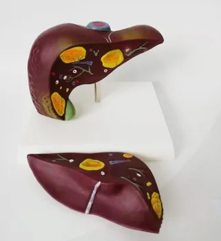 

liver structure model liver anatomy medical teaching aid