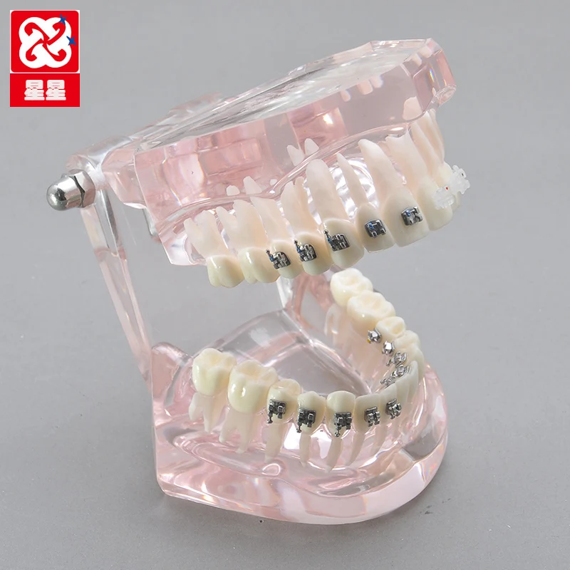 orthodontic appliance model four kinds of brackets contrast edgewise appliance