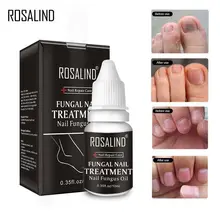 Исправление проблем с ногтями питательное решение для увеличения блеска для ногтей грибковое масло 1 шт. ремонт лак для ногтей TSLM1