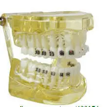 Ортодонтическая модель с 4 вида кронштейны зубной зуб зубы стоматолог стоматология зубные полоски для tyodont модель