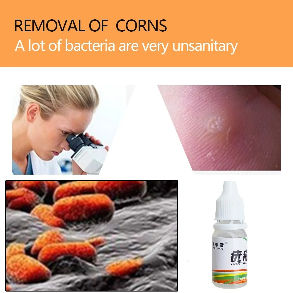 Body-Warts-Treatment-Cream-Skin-Tag-Remover-Foot-Corn-Removal-Plantar-Genital-Warts-Ointment-Foot-Care (4)