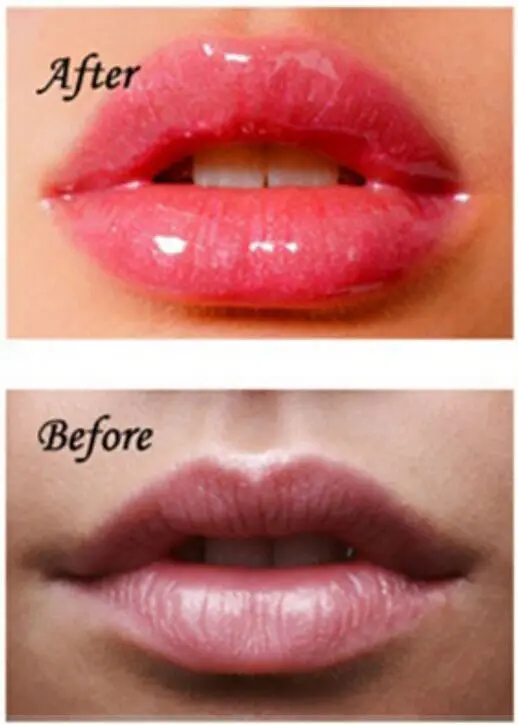 Professional Sexy Mouth Beauty Lip Pump Enhancement Luscious Lips Pump Device Quick Lip Plumper Enhancer Natural Fuller Bigger