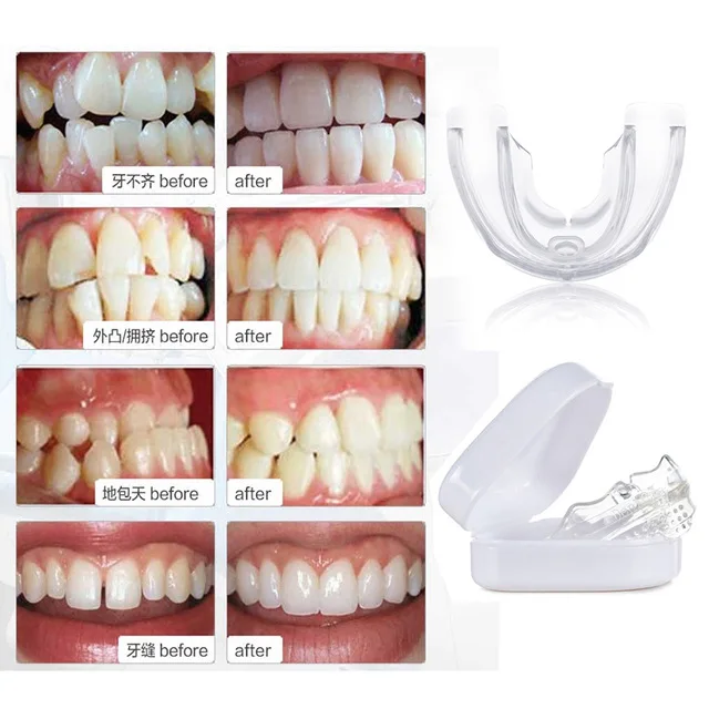 

New Adult Dental Tooth Orthodontics Dental Braces Teeth Whitening Dental Orthotics Tooth Alignment Tool Orthodontic Retainers