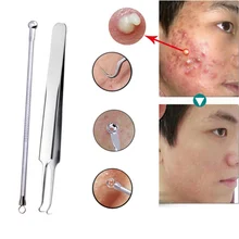 3 шт. уход за кожей из нержавеющей стали для удаления акне пятен для лица средство для удаления акне