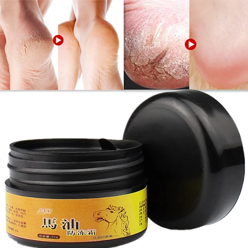 

Anti-Chapping Useful Horse Oil Foot Cream Skin Repairing Moisturizer For Rough Dry And Cracked Chapped Feet Heel