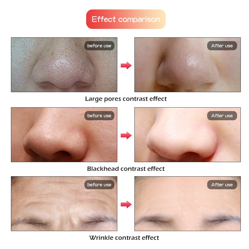 7 Colors Led Facial Mask Led Korean Photon Therapy Face Mask Machine Light Therapy Acne Mask Neck Beauty Spa Led Mask