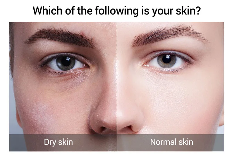 Hyaluronic-acid-snail-secretion-1_02