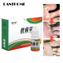 Черная точка моль бородавая метка на коже средство для удаления 12 часов Tu Kill жидкое медицинское средство для удаления мозолей Уход за ногами моль метка на коже решение для удаления