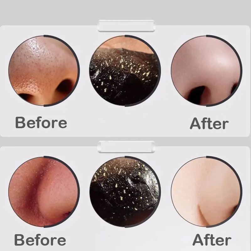 DR RASHEL черная маска для удаления черных точек носа отшелушивающая лица Лечение